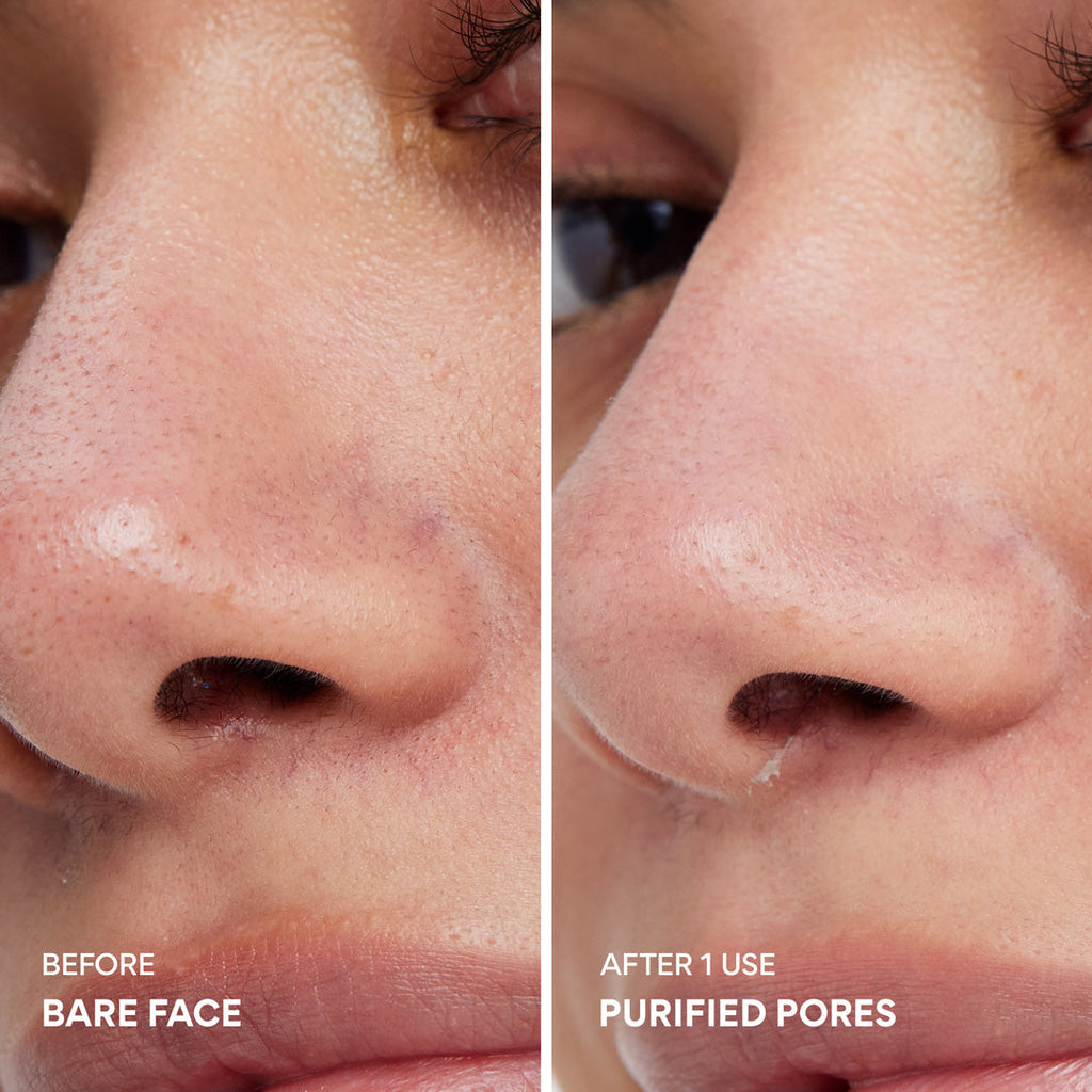 Super Volcanic Pore Clay Mask – Deep Cleanse & Clear Face Pores